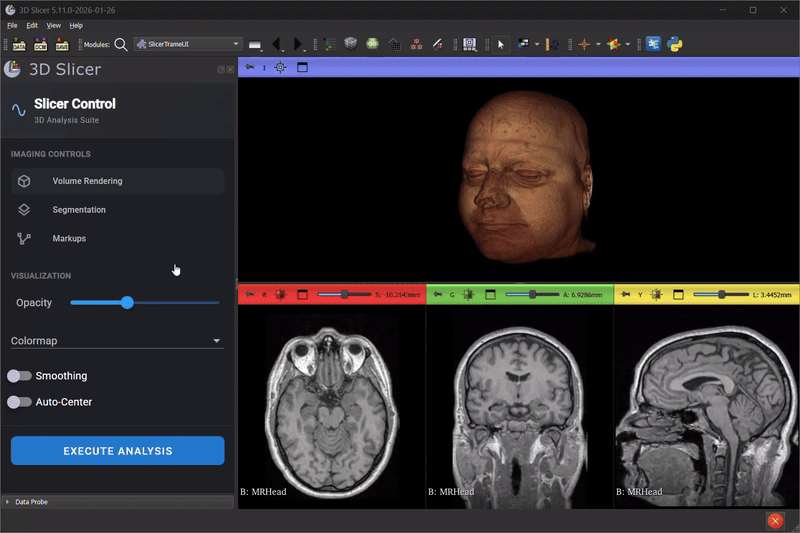 Slicer Trame UI